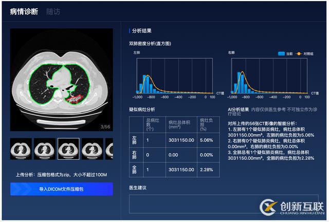 百度「AI戰疫」：首次開源肺炎CT影像分析模型，讓診斷從分鐘到秒